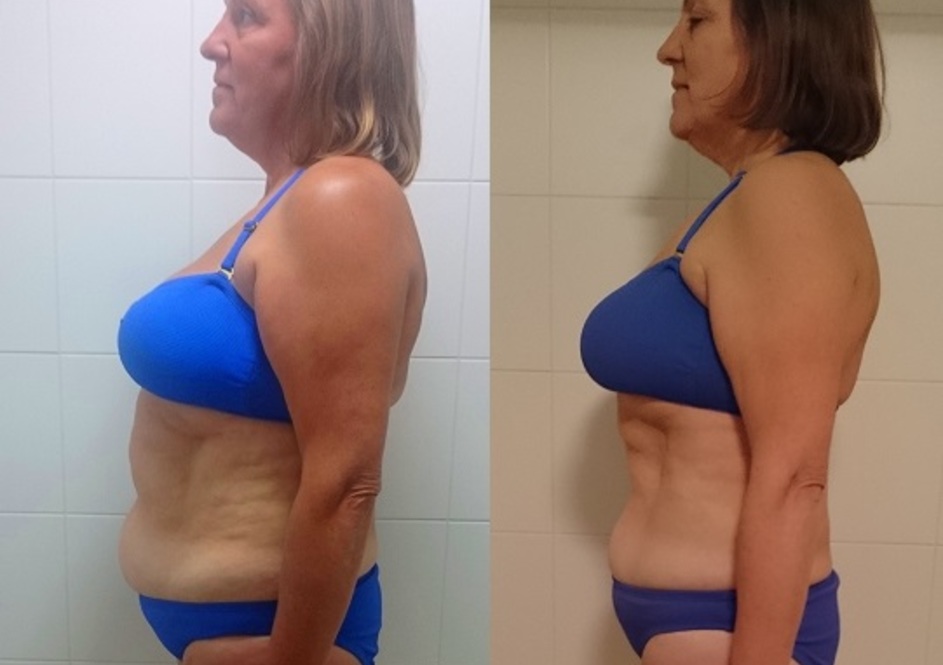 Jane - Fat Loss